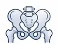 Hip