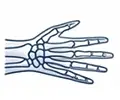 hand